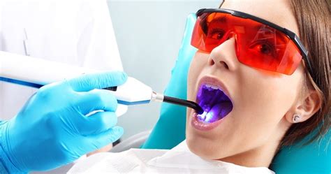 affordable dental bonding las vegas