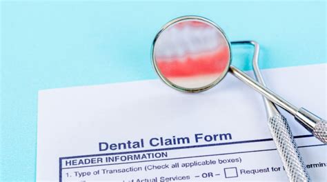 bond dental billing