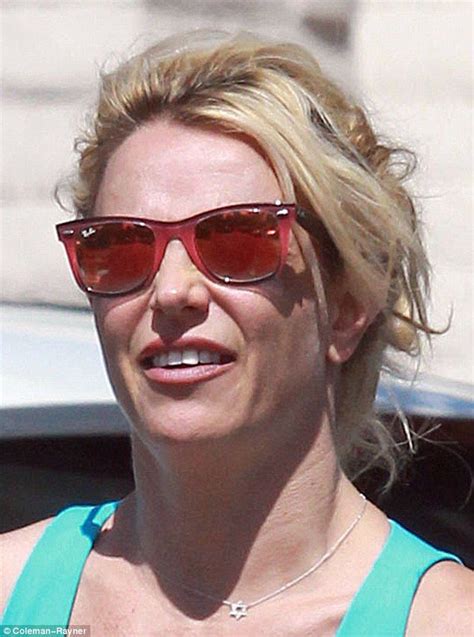 britney spears dental bonding