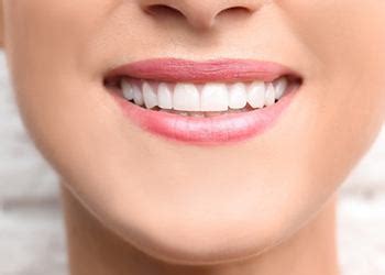 dental bonding falls church