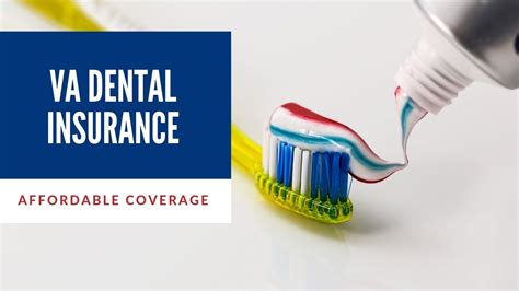 does delta dental insurance cover bonding